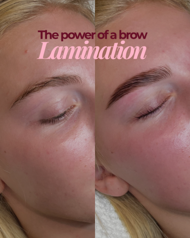 GBN brow lamination